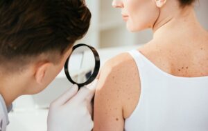 What's the Difference Between Melanoma and Nonmelanoma Skin Cancer?