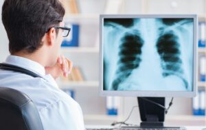 Advances in Lung Cancer Treatment Resulting in Lower Death Rates
