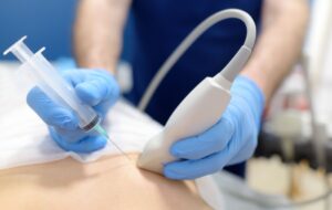Making Sense of Your Breast Biopsy