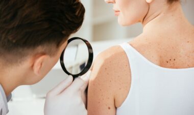 What's the Difference Between Melanoma and Nonmelanoma Skin Cancer?