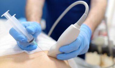Making Sense of Your Breast Biopsy