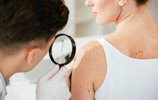 What's the Difference Between Melanoma and Nonmelanoma Skin Cancer?