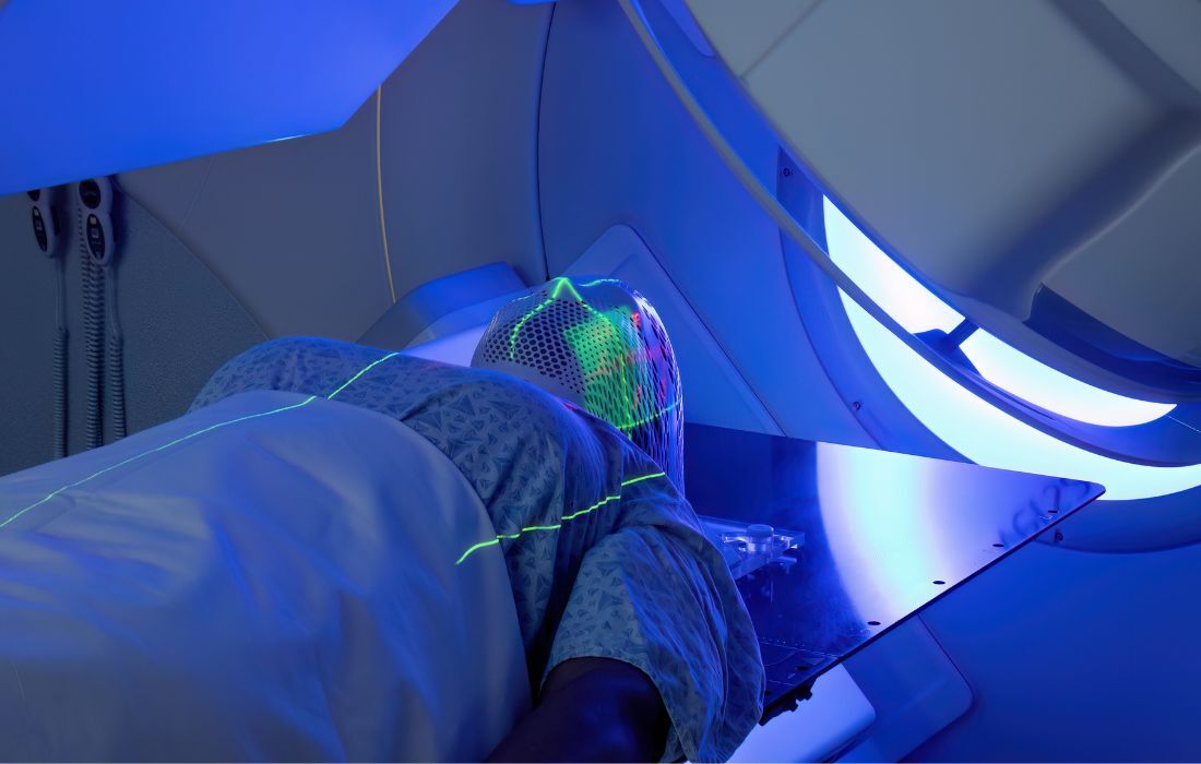 radiation for head and neck cancer treatment